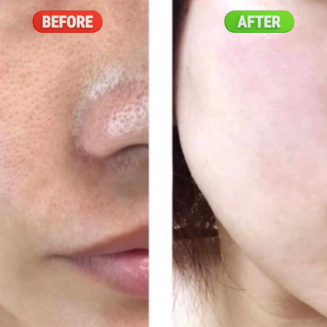 Vitamin C Glow Serum – 30ML