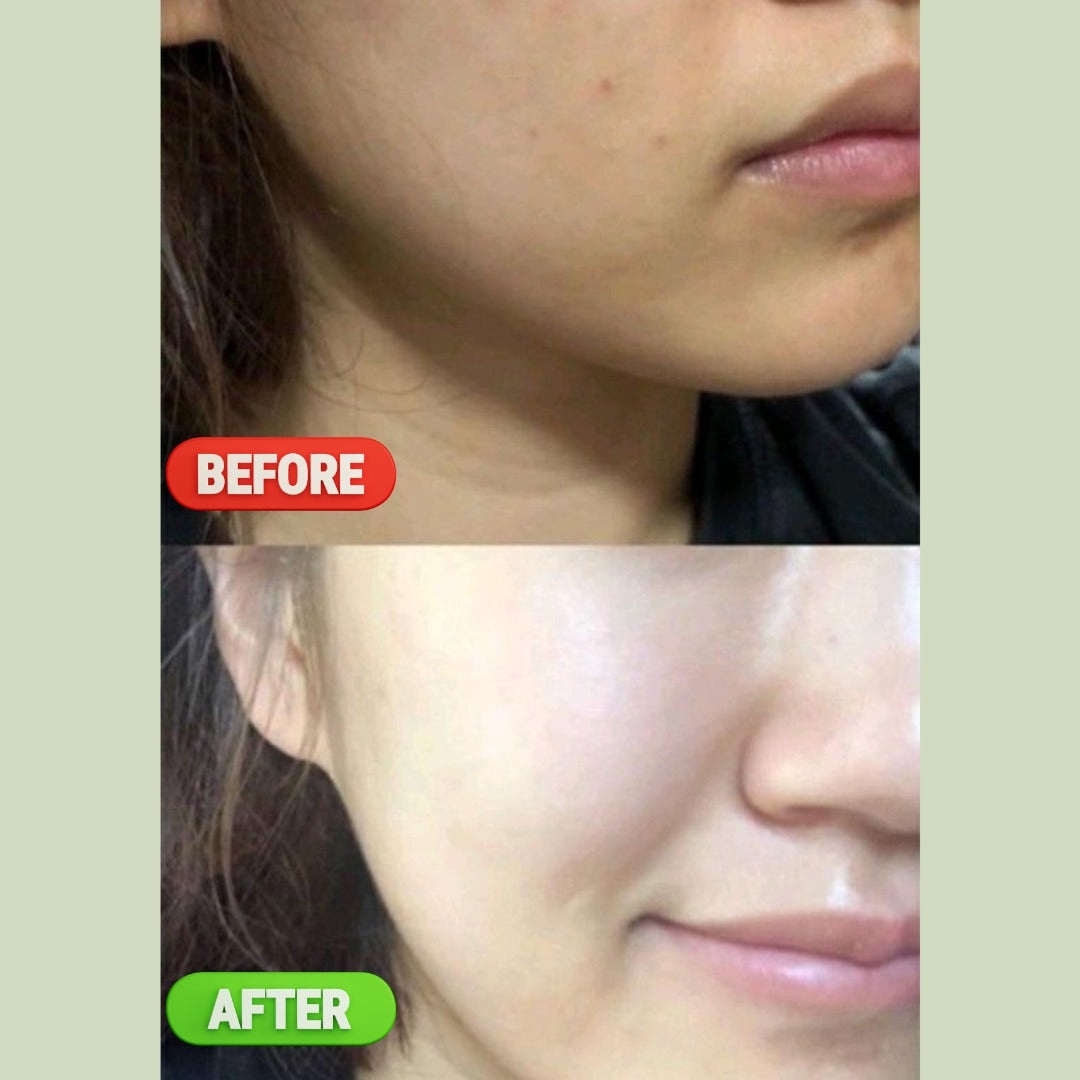 Vitamin C Glow Serum – 30ML