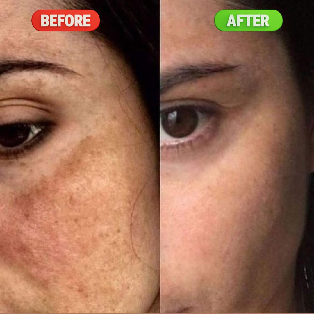 Advanced Brightening & Dark Spot Correcting Serum – 30ML