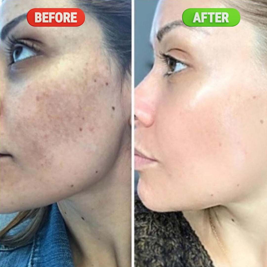 Advanced Brightening & Dark Spot Correcting Serum – 30ML