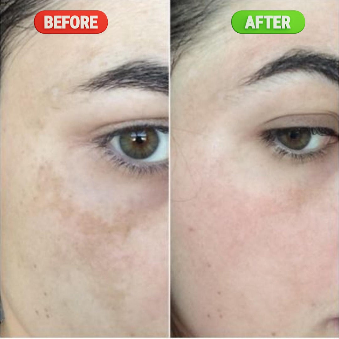 Advanced Brightening & Dark Spot Correcting Serum – 30ML