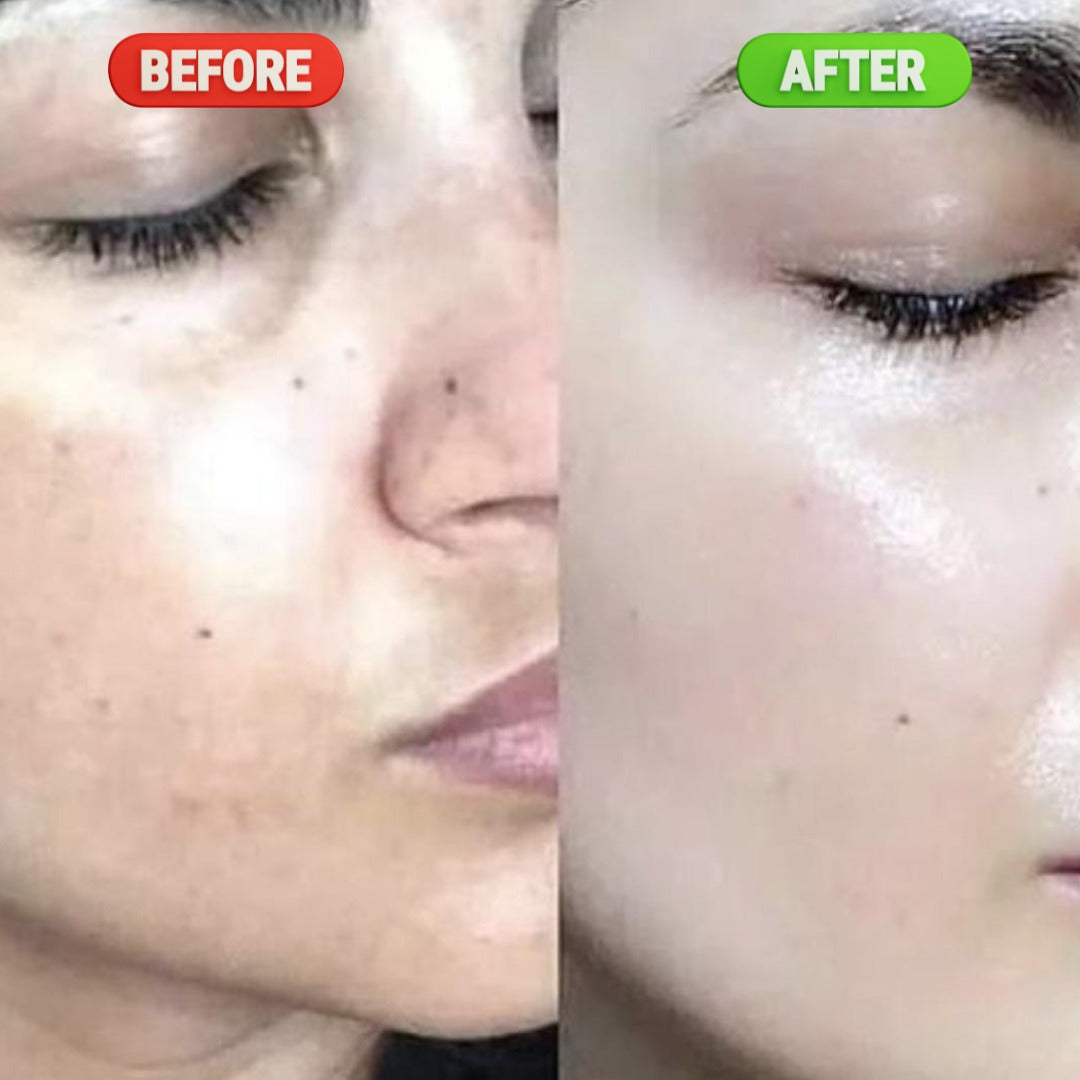 Advanced Brightening & Dark Spot Correcting Serum – 30ML