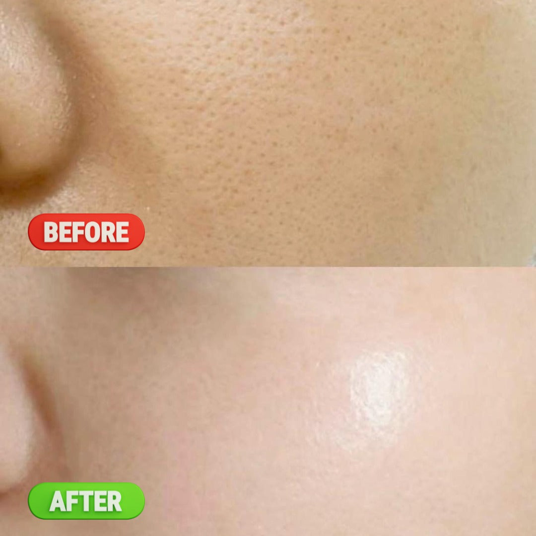 Pore Refining & Oil Control Serum - 30ML