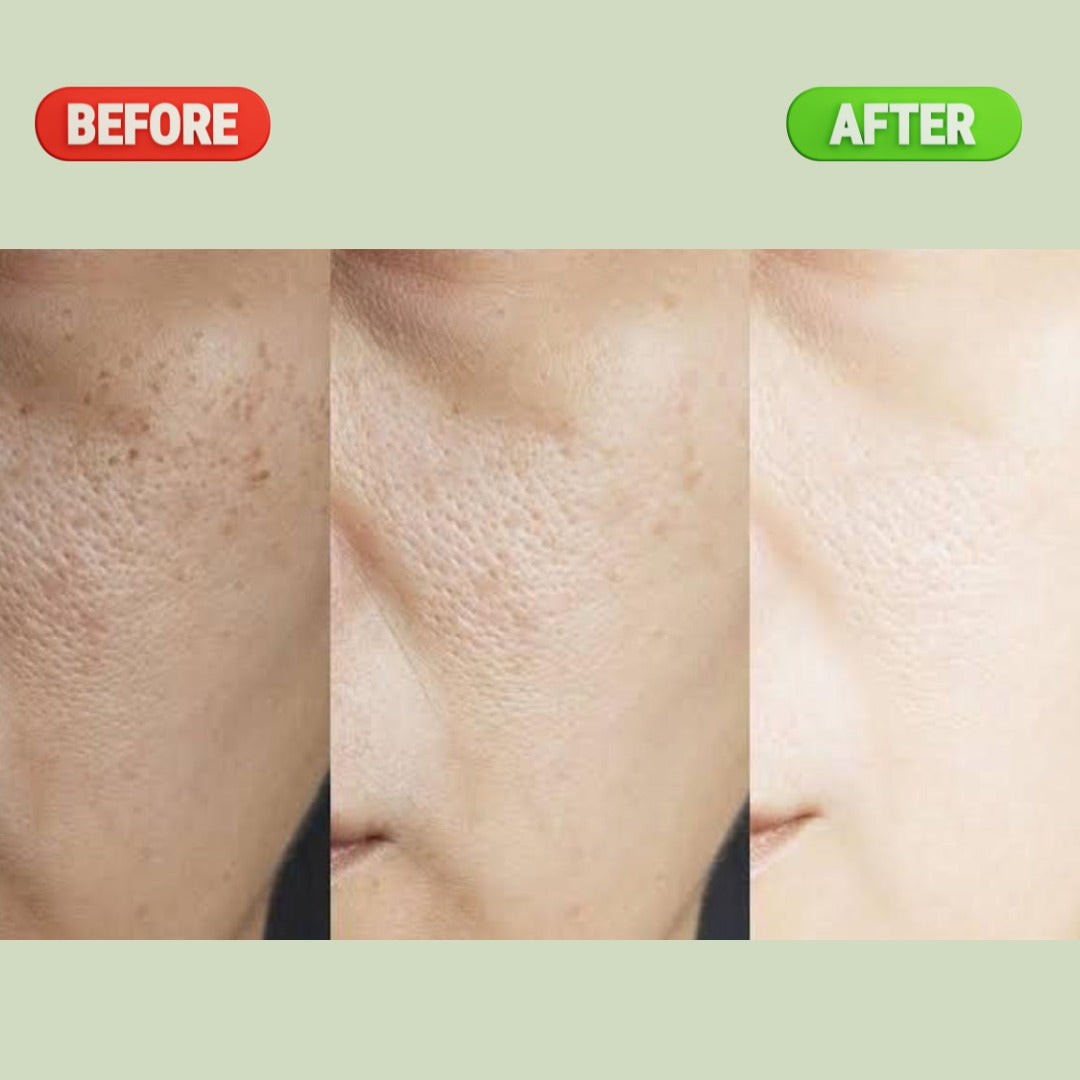Pore Refining & Oil Control Serum - 30ML