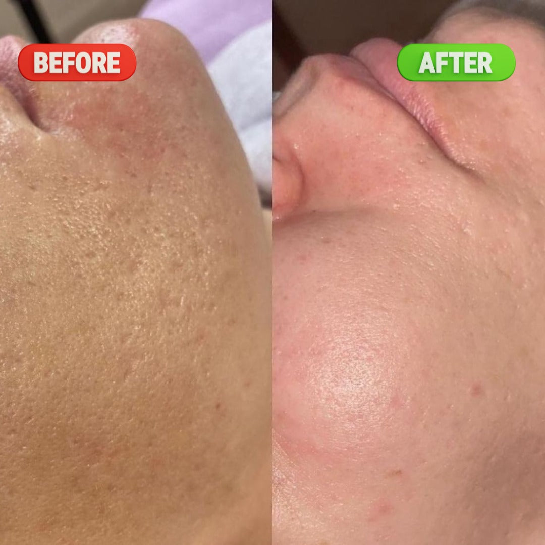 Pore Refining & Oil Control Serum - 30ML