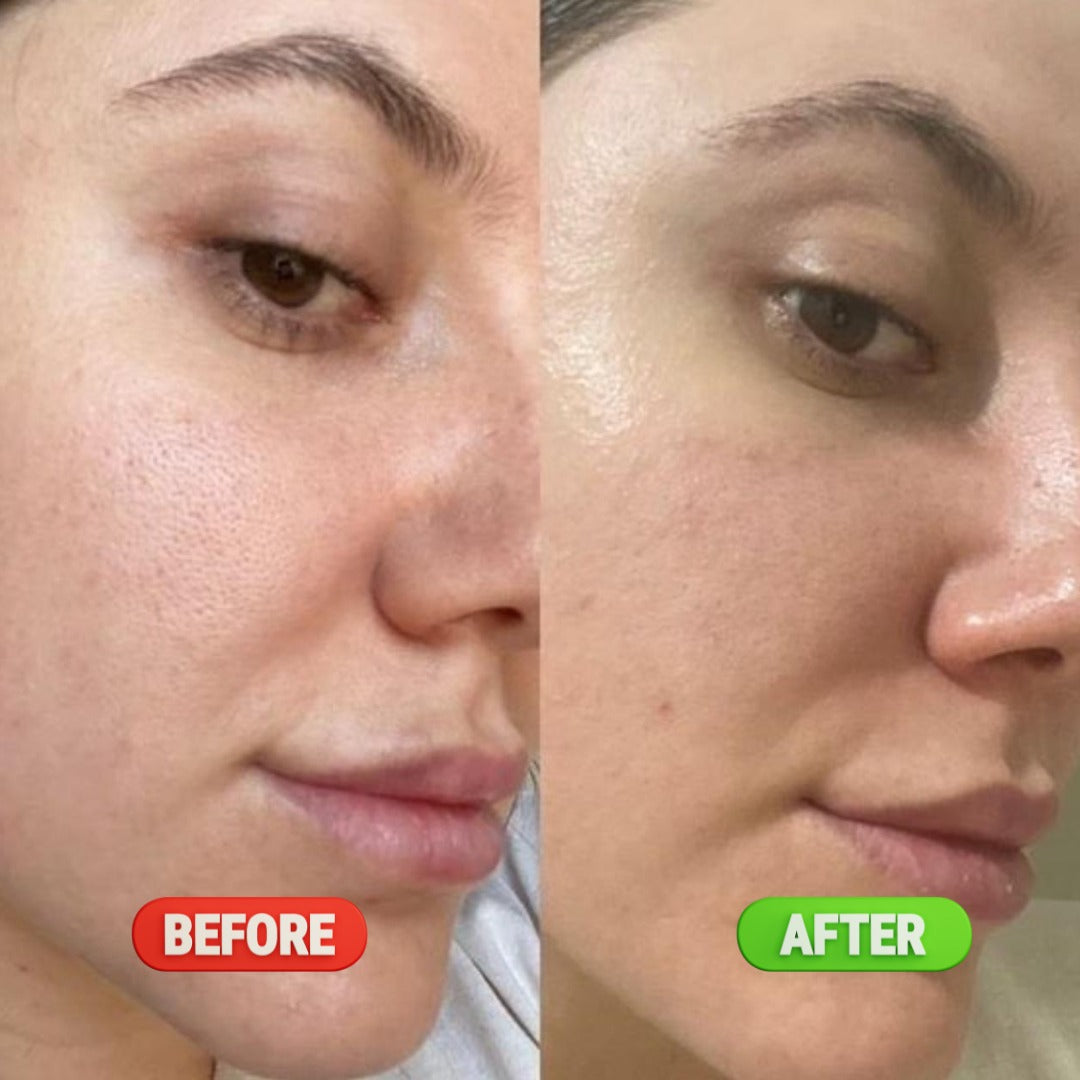 Pore Refining & Oil Control Serum - 30ML